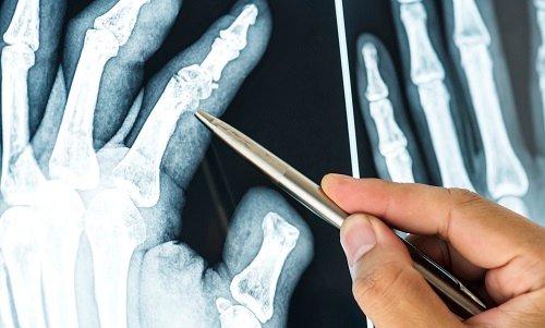 Trauma Orthopedic Surgeon